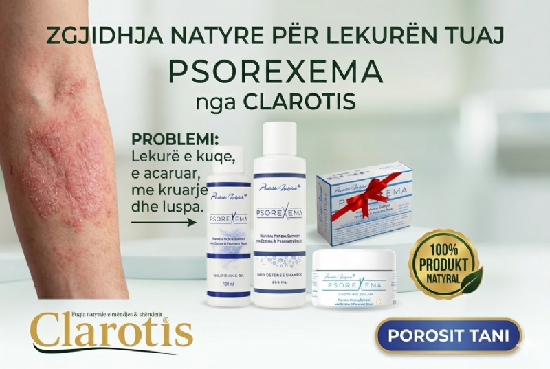 PSOREXEMA suplement nga CLAROTIS, eczema supplement, psoriasis capsules, natural skin support, herbal supplement skin, immune support skin, detox skin capsules, skin inflammation supplement, capsules eczema relief, herbal detox