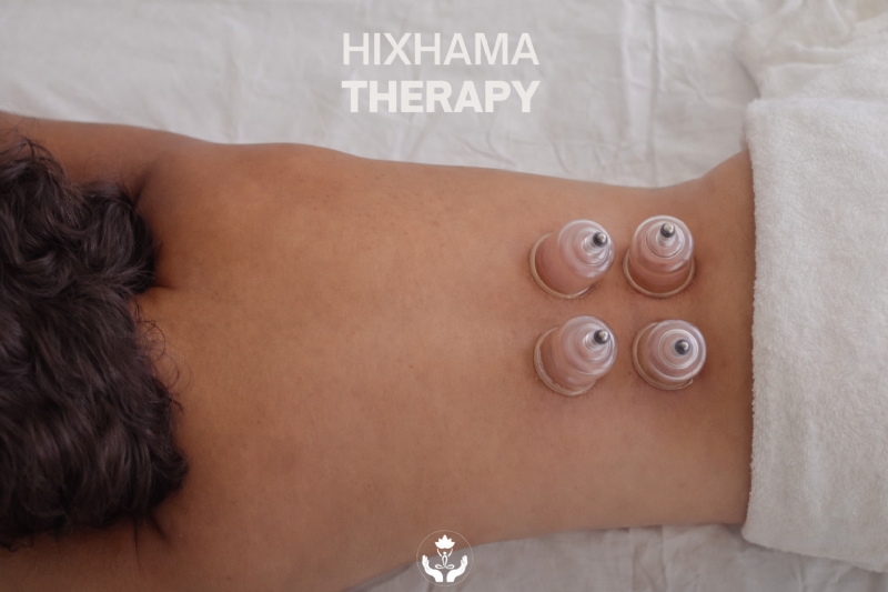 Hixhama, hixhama Tirana, hixhama therapy, hijama therapy, hijama Tirana, terapi hixhama, terapi hijama, hixhama profesionale, terapi me kupa, cupping therapy Tirana, kupa terapeutike, kupa per qarkullimin e gjakut, kupa per detoks